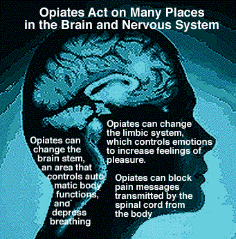 Convincing an Opiate Addict to get Opiate Addiction Treatment