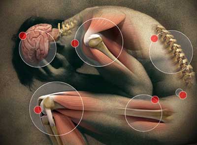 Dealing with Opiate Withdrawal Symptoms